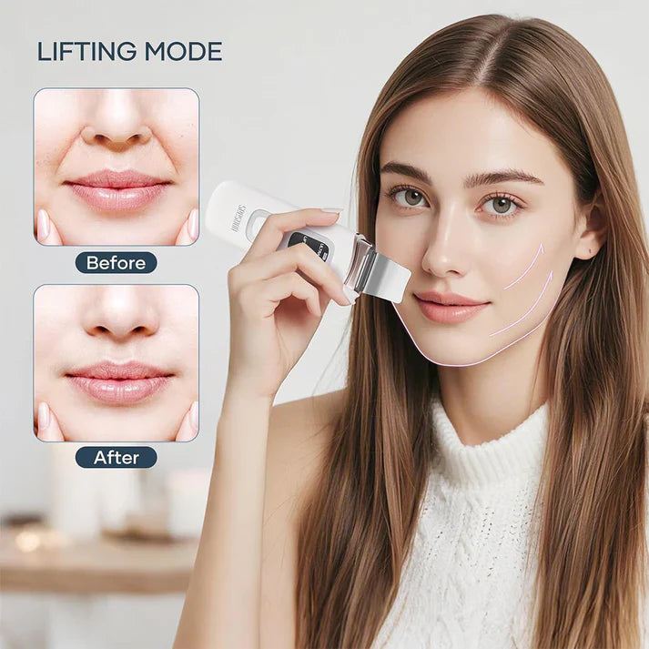 Strălucire – Scruber Facial cu Ultrasunete